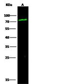 C1 inhibitor Antibody in Western Blot (WB)