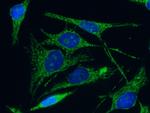 C1QBP Antibody in Immunocytochemistry (ICC/IF)