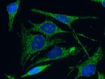 C1QBP Antibody in Immunocytochemistry (ICC/IF)