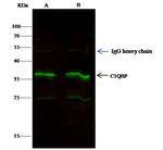 C1QBP Antibody in Immunoprecipitation (IP)