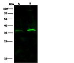 IFNAR2 Antibody in Western Blot (WB)