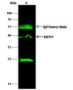 Cytokeratin 19 Antibody in Immunoprecipitation (IP)