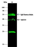 Cytokeratin 19 Antibody in Immunoprecipitation (IP)