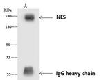 Nestin Antibody in Immunoprecipitation (IP)