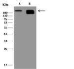 Nestin Antibody in Western Blot (WB)