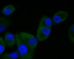 SV2B Antibody in Immunocytochemistry (ICC/IF)