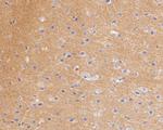 SV2B Antibody in Immunohistochemistry (Paraffin) (IHC (P))