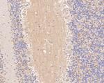 SV2B Antibody in Immunohistochemistry (Paraffin) (IHC (P))