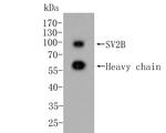 SV2B Antibody in Western Blot (WB)