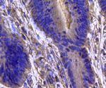 IDH1 Antibody in Immunohistochemistry (Paraffin) (IHC (P))