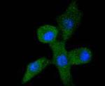 Acetyl-p53 (Lys382) Antibody in Immunocytochemistry (ICC/IF)