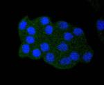 Acetyl-p53 (Lys382) Antibody in Immunocytochemistry (ICC/IF)