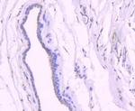 Acetyl-p53 (Lys382) Antibody in Immunohistochemistry (Paraffin) (IHC (P))