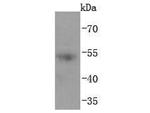 Acetyl-p53 (Lys382) Antibody in Western Blot (WB)