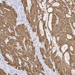 beta Catenin Antibody in Immunohistochemistry (Paraffin) (IHC (P))