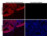 beta Catenin Antibody in Immunohistochemistry (Paraffin) (IHC (P))