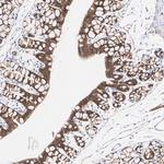 beta Catenin Antibody in Immunohistochemistry (Paraffin) (IHC (P))