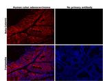 beta Catenin Antibody in Immunohistochemistry (Paraffin) (IHC (P))