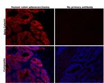 beta Catenin Antibody in Immunohistochemistry (Paraffin) (IHC (P))