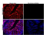 beta Catenin Antibody in Immunohistochemistry (Paraffin) (IHC (P))