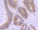 beta Catenin Antibody in Immunohistochemistry (Paraffin) (IHC (P))