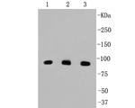 beta Catenin Antibody in Western Blot (WB)