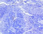 Survivin Antibody in Immunohistochemistry (Paraffin) (IHC (P))