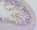 Survivin Antibody in Immunohistochemistry (Paraffin) (IHC (P))