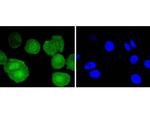 Bcl-2 Antibody in Immunocytochemistry (ICC/IF)