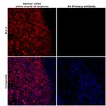 Bcl-2 Antibody in Immunohistochemistry (Paraffin) (IHC (P))