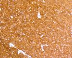 Tau Antibody in Immunohistochemistry (Paraffin) (IHC (P))