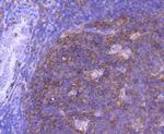 MEK1 Antibody in Immunohistochemistry (Paraffin) (IHC (P))