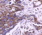 MEK1 Antibody in Immunohistochemistry (Paraffin) (IHC (P))