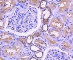 MEK1 Antibody in Immunohistochemistry (Paraffin) (IHC (P))