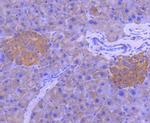 MEK1 Antibody in Immunohistochemistry (Paraffin) (IHC (P))