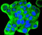 Cytokeratin 18 Antibody in Immunocytochemistry (ICC/IF)