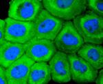 Cytokeratin 18 Antibody in Immunocytochemistry (ICC/IF)