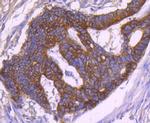 Cytokeratin 18 Antibody in Immunohistochemistry (Paraffin) (IHC (P))