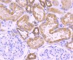 Cytokeratin 18 Antibody in Immunohistochemistry (Paraffin) (IHC (P))