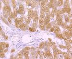 Cytokeratin 18 Antibody in Immunohistochemistry (Paraffin) (IHC (P))