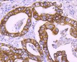 Cytokeratin 18 Antibody in Immunohistochemistry (Paraffin) (IHC (P))