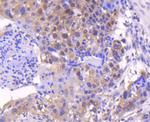 SMAD4 Antibody in Immunohistochemistry (Paraffin) (IHC (P))