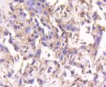 SMAD4 Antibody in Immunohistochemistry (Paraffin) (IHC (P))