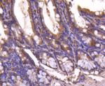 SMAD4 Antibody in Immunohistochemistry (Paraffin) (IHC (P))