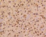 SMAD4 Antibody in Immunohistochemistry (Paraffin) (IHC (P))