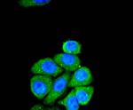 SMAD2 Antibody in Immunocytochemistry (ICC/IF)