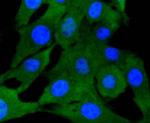 SMAD2 Antibody in Immunocytochemistry (ICC/IF)