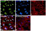 SMAD2 Antibody in Immunocytochemistry (ICC/IF)