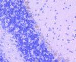 SMAD2 Antibody in Immunohistochemistry (Paraffin) (IHC (P))