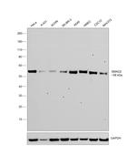 SMAD2 Antibody in Western Blot (WB)